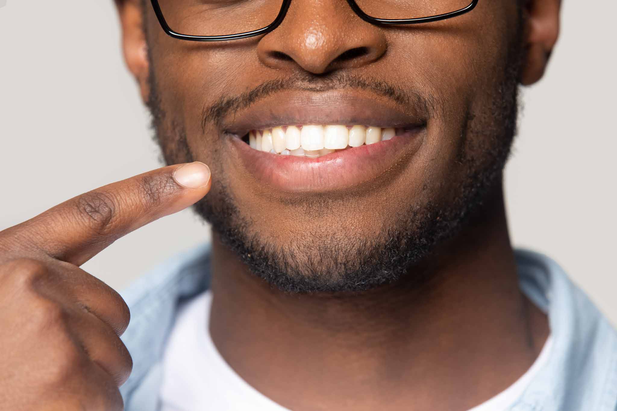 Young male patient pointing at his smile