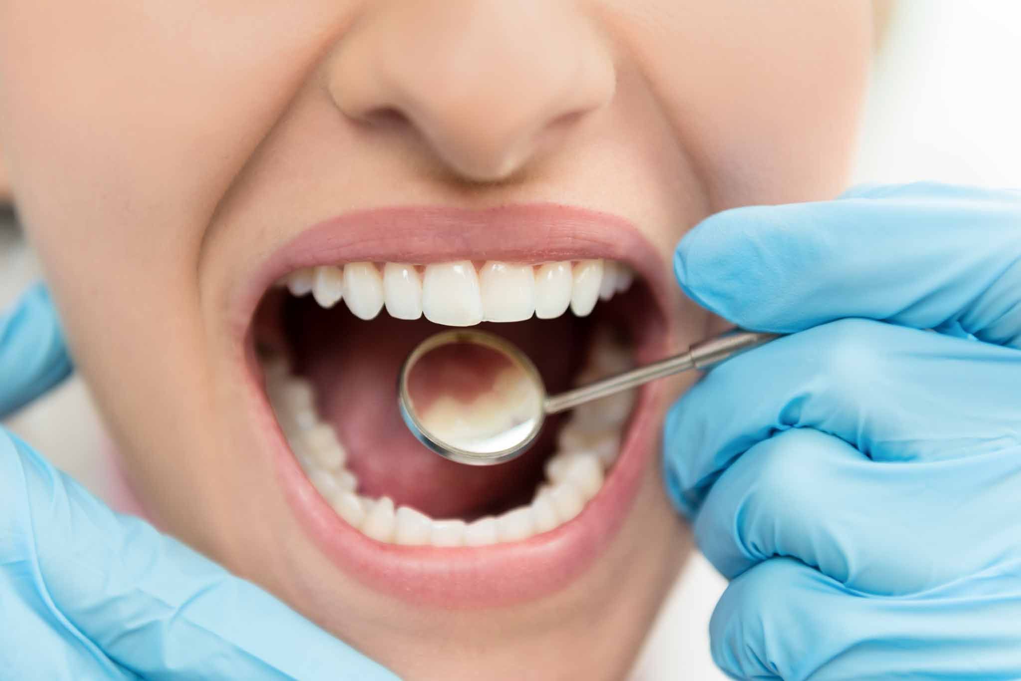 close-up image of young woman having dental exam